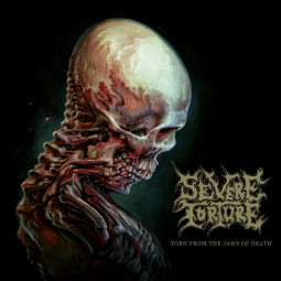 SEVERE TORTURE - TORN FROM THE JAWS OF DEATH - CD